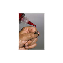 Verletzung / Wunde: Nagelriss Verletzung / Wunde: Nagelriss